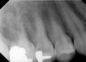 Modern dental office best dentist North Hollywood — digital X-rays technology A-Dental Center