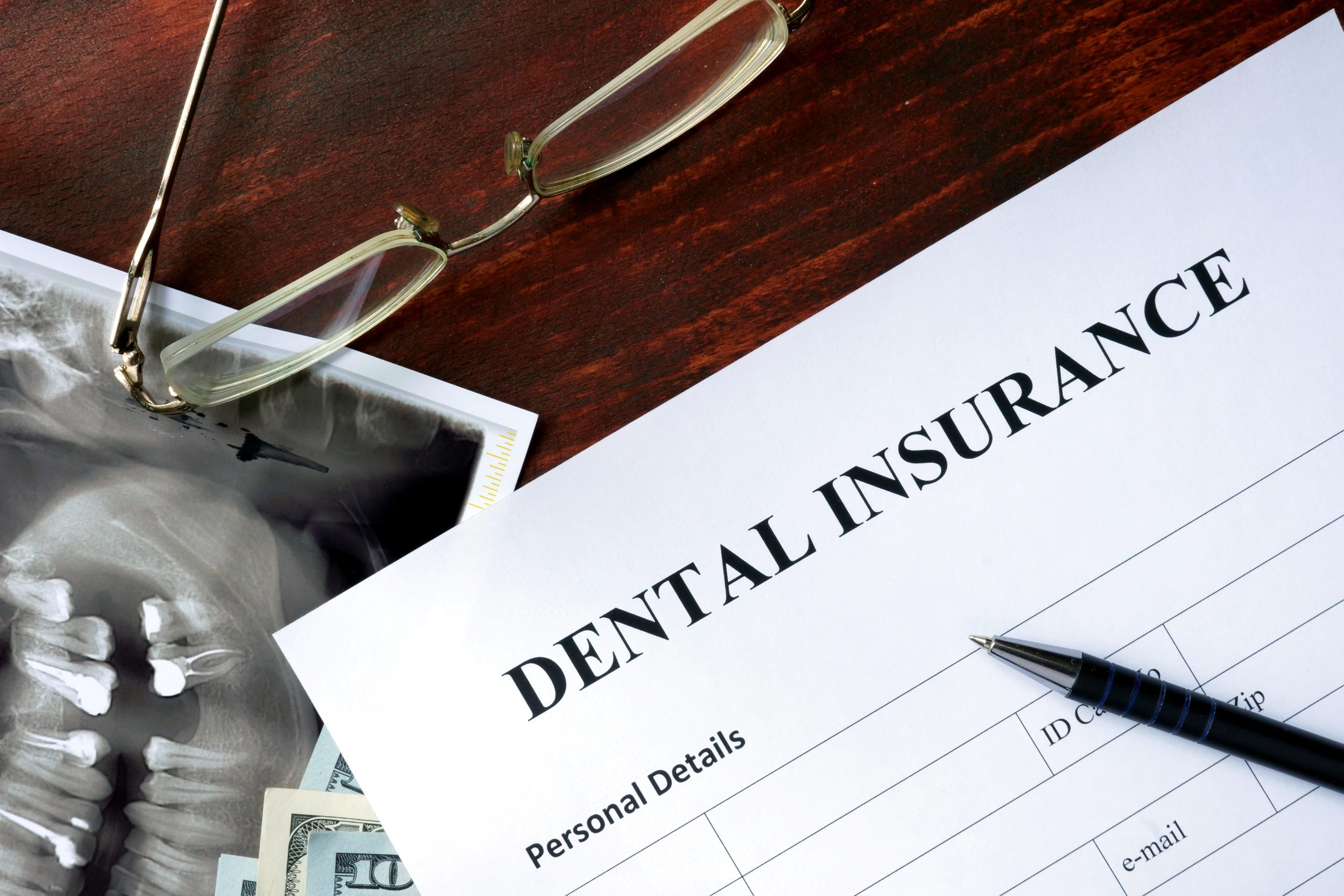 Use dental insurance before expires North Hollywood — year end benefits A-Dental Center