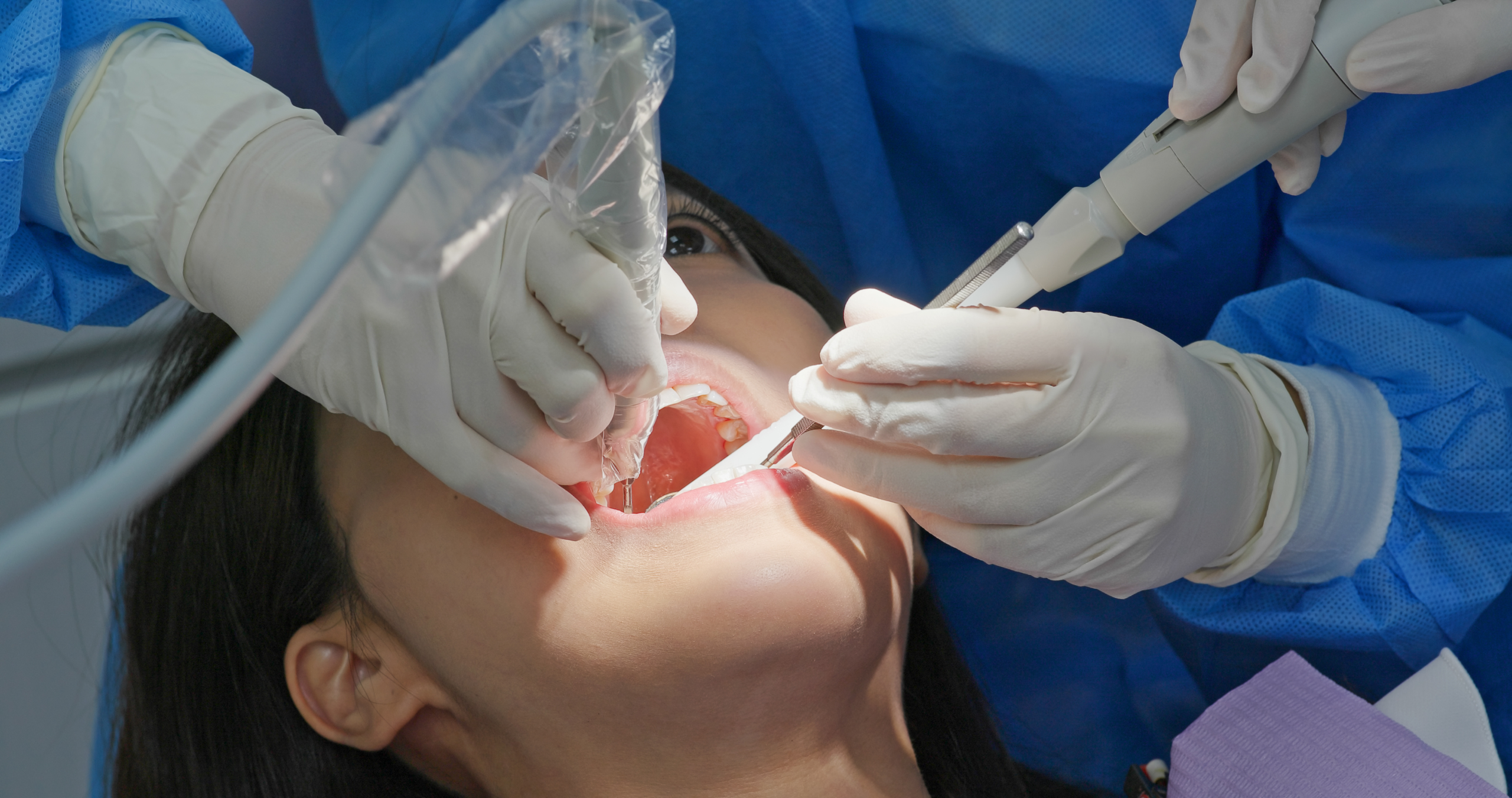 post and core restorations in North Hollywood CA