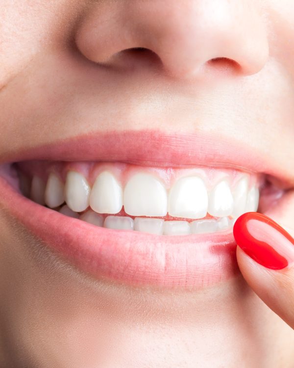 Cosmetic Dentistry in North Hollywood Dentist near Panorama City