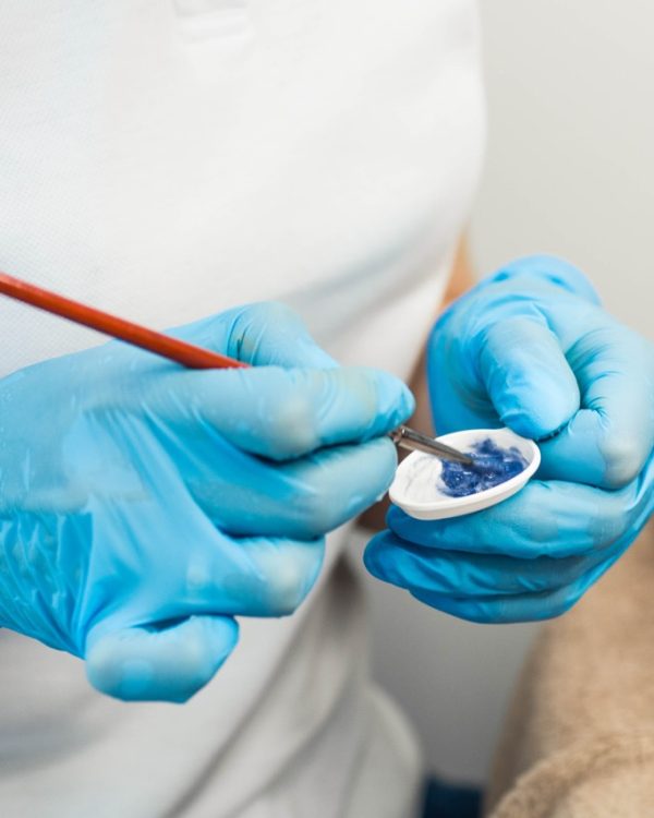 Dental Sealants in North Hollywood CA