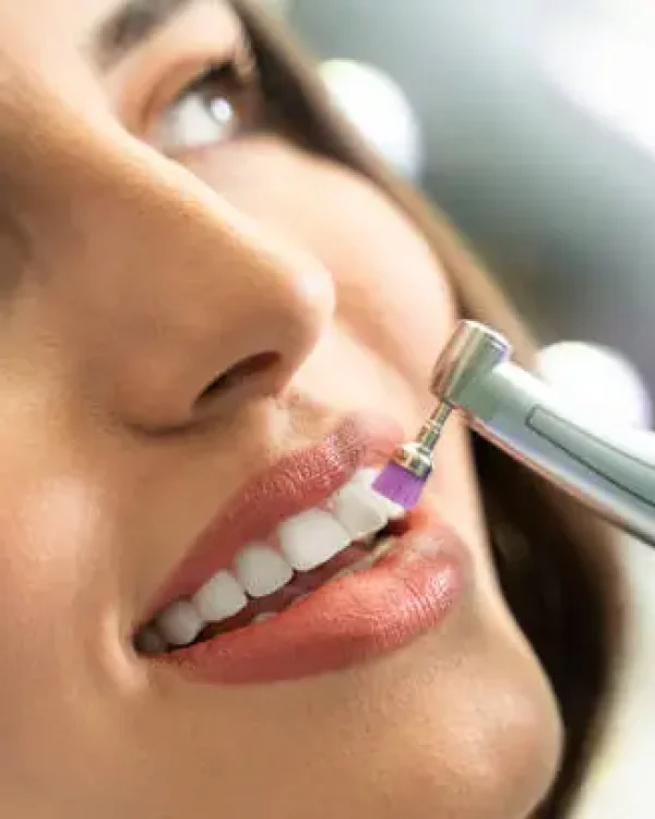 Dental Cleanings in North Hollywood, CA
