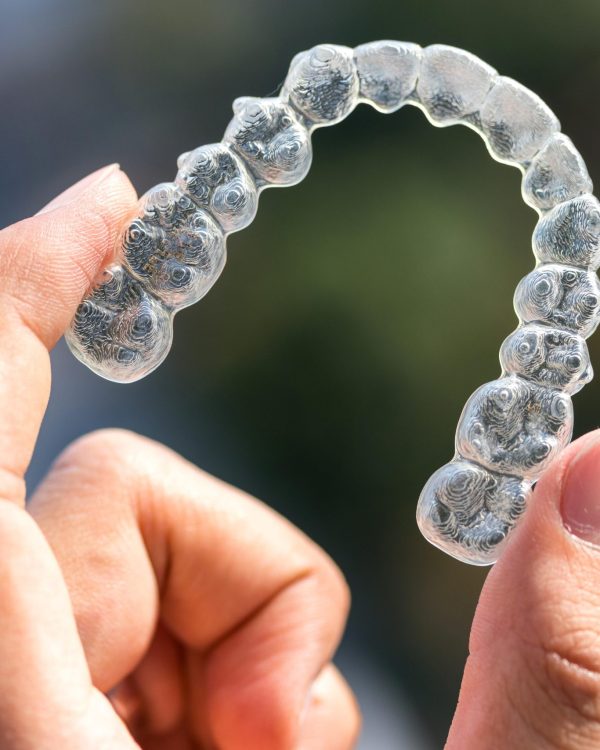 Invisalign North Hollywood vs braces — clear aligner treatment A-Dental Center Dentist near Northridge